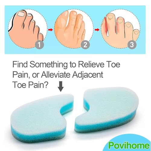 Povihome 20 Pack Foam Toe Spacers(2/5" Thick), 3-Layer Toe Separators - Large Size - to Align Crooked, Overlapping Toe, Relieve Corn, Blister and Reduce Irritation - size: Large (Pack of 20)