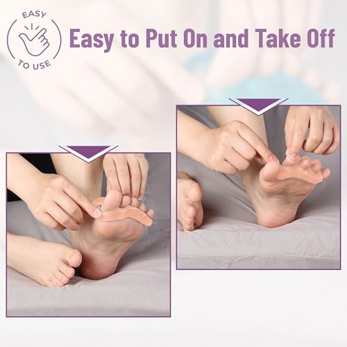 Dr. JK- ToePal Gel Toe Separator, 4 Pairs, Blush, Toe Spacers, Bunion Corrector - color: Blush, size: 4 Pairs