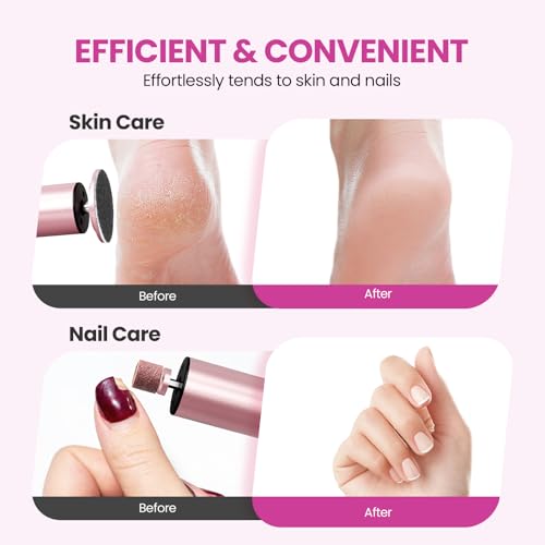Electric Foot Callus Remover 6 Speed Adjustable for Women Mom Lover - color: Rose Pink