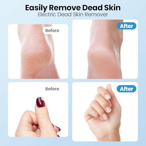 2-in-1 Electric Callus Remover for Feet, Professional Pedicure Tools Gift - color: Pollen Pink