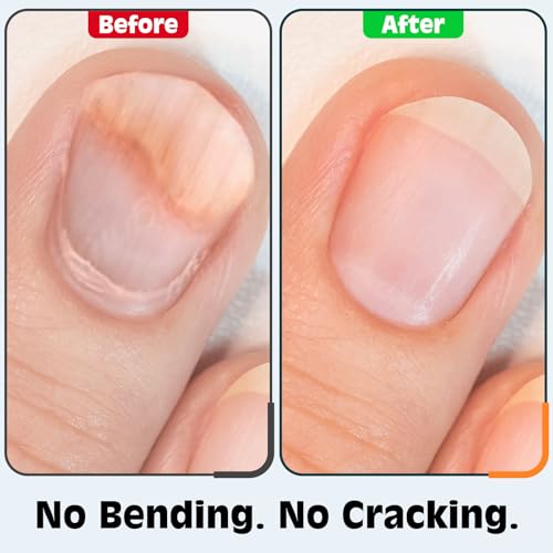 Nail Clippers Set, Fingernail and Toenail Clipper Cutters Kit - color: 3Pack - Jet Black