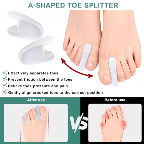 10-Pack Gel Toe Separators for Straightening Overlapping Toes, Men & Women
