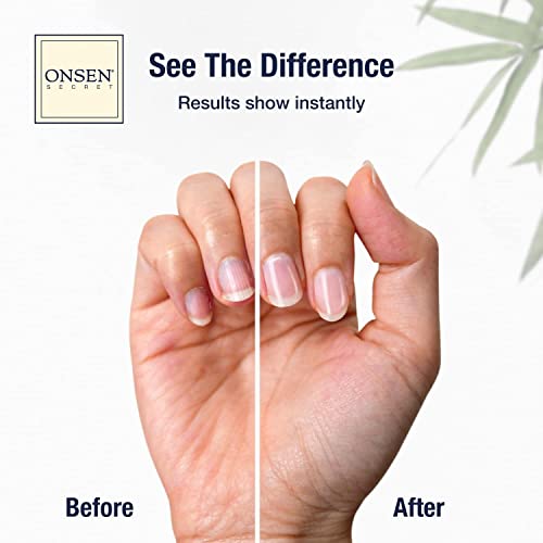 ONSEN Japanese Nail File Buffer Sparkle-KIT 1.0, A Free 120/180 Grit Nail File,3-Way Buffer Block, Cuticle Serum with Cuticle Oil in Action-15ml, Optimum Care Series - size: 0.51 Fl Oz (Pack of 1)