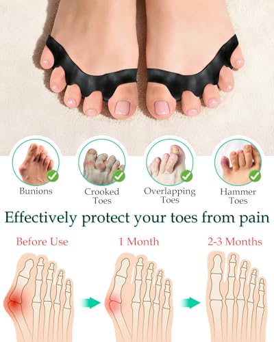 4PCS Silicone Toe Separators to Correct Toes Alignment for Women and Men, Toe Spacers Straightener for Bunion Relief, Hammertoes and Overlapping Toes (Large) - size: Large