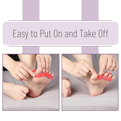 Dr. JK- ToePal Gel Toe Separator, 2 Pairs, Toe Spacers, Bunion Corrector - color: Red, size: 2 Pairs
