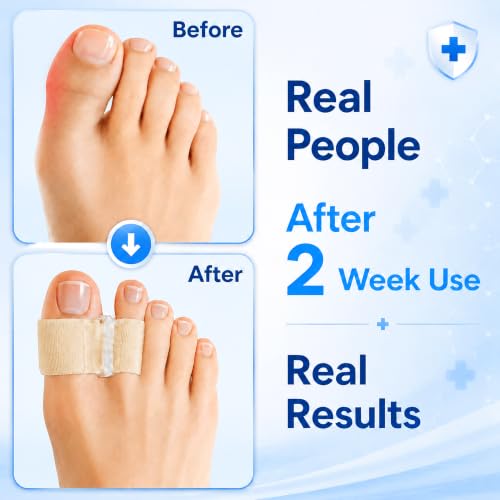 Big Toe Separators, 2-Loop Soft Gel Toe Spacers, 3 Sizes, Washable - color: Beige, size: M:MEN 6.5-9/WOMEN 9.5-11