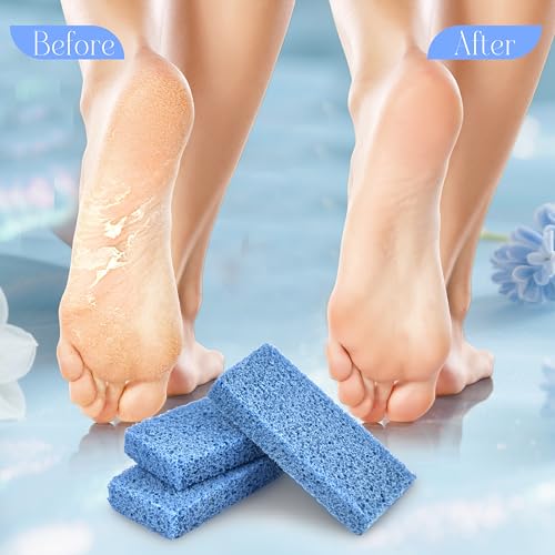 SALVMARY Foot Pumice Stone for Feet Callus Remover Scrubber Pads 40 Pcs