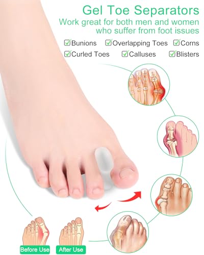 PGRODE 12 Pack Gel Toe Separators Silicone Toe Spacers for Women Men Bunion Corrector Toe Pain Relief, Toe Alignment, Soft Toe Spacer for Crooked Toes, Overlapping Toes, Hammertoe Correction (Small) - size: Small