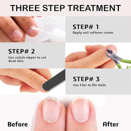 1piece Cuticle Trimmer Nipper 9 Color (Green) - color: Green Nipper - Pack 1