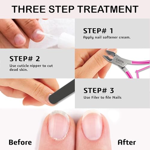1piece Cuticle Trimmer Nipper 9 Color (Pink) - color: Pink Nipper - Pack 1