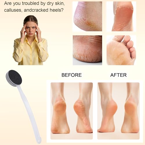 Pumice Stone for Feet with Long Handle 13.7", Double Sided Pedicure Tool for Hard Skin Callus Remover, Foot Scrubber and Exfoliator with Sand Paper for Softer & Smoother Feet, Clear White - color: Clear White