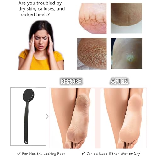 Double Sided Pumice Stone for Feet with Long Handle 13.7", Hard Skin Callus Remover, Foot Scrubber and Exfoliator Pedicure Tool with Sand Paper for Softer & Smoother Feet, Clear Black - color: Clear Black