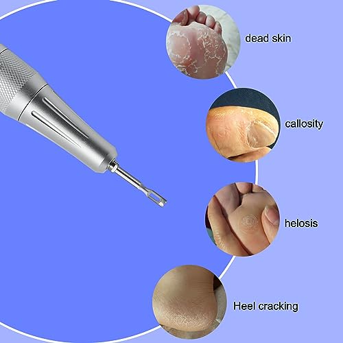 Diamond Pedicure Cylinder Bit, Stainless Steel Foot Nail Drill Bit With Teeth Pedicure Foot Calluses for Dead Skin Corns Callus Removal, Polishing Head for Nails Manicure Pedicures (3.0mm) - color: Mold B