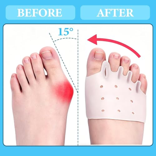 VEADONS 4 PCS Toe Separators, Silicone Toe Separators for Women & Men, Toe Spacers, Bunion Corrector, Hammer Toe Straighteners & Plantar Fasciitis, Comfortable & Breathable