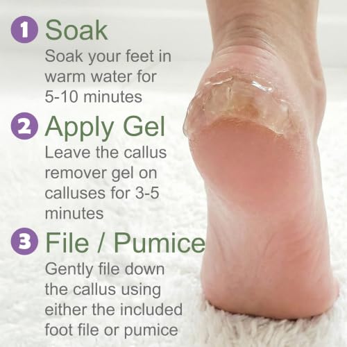Foot Callus Remover Gel Kit: Complete At Home Callus Remover for Feet 8 oz