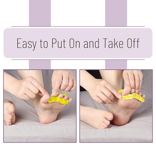 Dr. JK- ToePal Gel Toe Separator, 2 Pairs, Toe Spacers, Bunion Corrector - color: Yellow, size: 2 Pairs