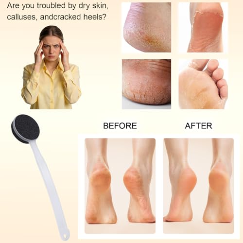 Double Sided Pumice Stone for Feet with Long Handle 13.7", Hard Skin Callus Remover, Foot Scrubber and Exfoliator Pedicure Tool with Sand Paper for Softer & Smoother Feet, Clear White - color: Black Pumice