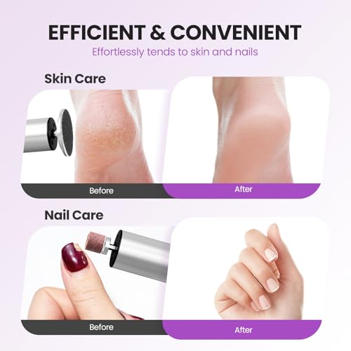 2-in-1 Electric Callus Remover for Feet, Professional Pedicure Tool Gift - color: Sliver
