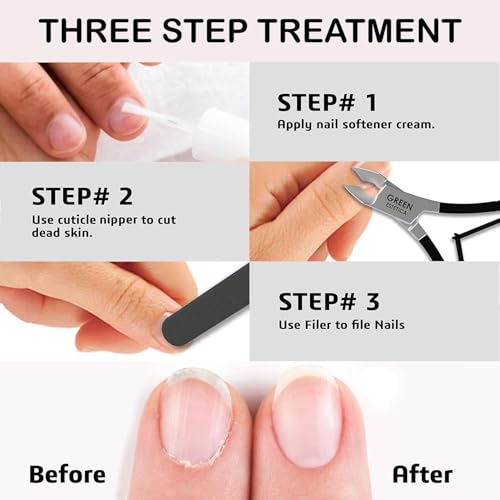 1piece Cuticle Trimmer Nipper 9 Color (Black) - color: Black