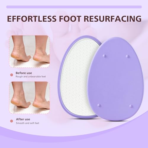 BALUCA Glass Foot File Callus Remover for Feet - Nano Glass Foot Scraper Scrubber Dead Skin Removal for Cracked Heels,Professional Pedicure Tool for Home, Salon, and Travel (Purple) - color: Purple