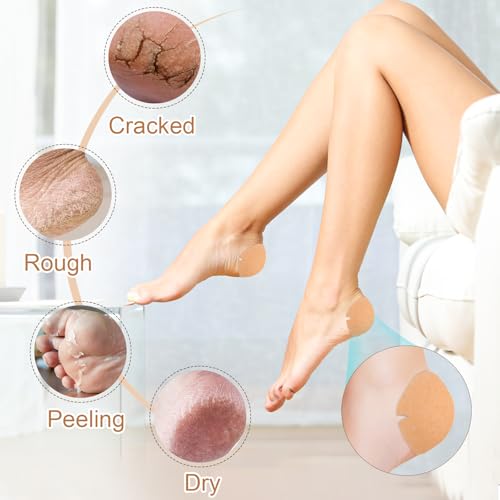 TEAWOO 30PCS Patented Cracked Heel Treatment Patches, New Upgraded Cracked Heel Repair Bandage (80mm x 80mm) - size: PURE