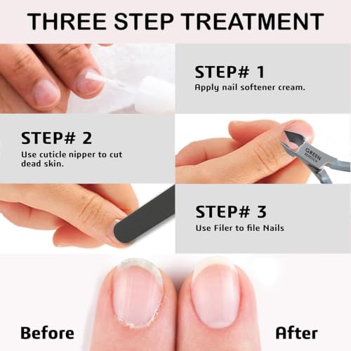1piece Cuticle Trimmer Nipper 9 Color (Gray) - color: Gray Nipper - Pack 1