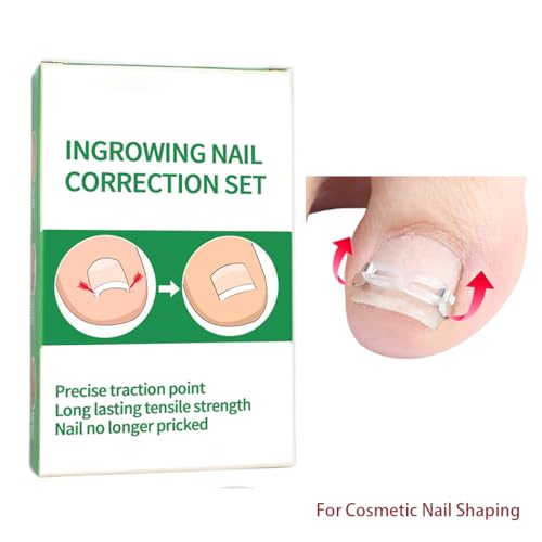 Ingrown Toenail Correction Kit