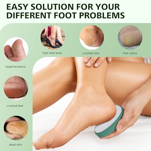 BALUCA Glass Foot File Callus Remover for Feet - Nano Glass Foot Scraper Scrubber Dead Skin Removal for Cracked Heels,Professional Pedicure Tool for Home, Salon, and Travel (Green) - color: Green