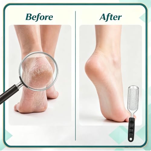 14 Pack Colossal Foot File Pedicure Tools Sets with 2 Styles Large and Small Hole Replacement Callus Remover Blades, Stainless Steel Detachable Pedicure Foot Rasp for Dead Skin Remover