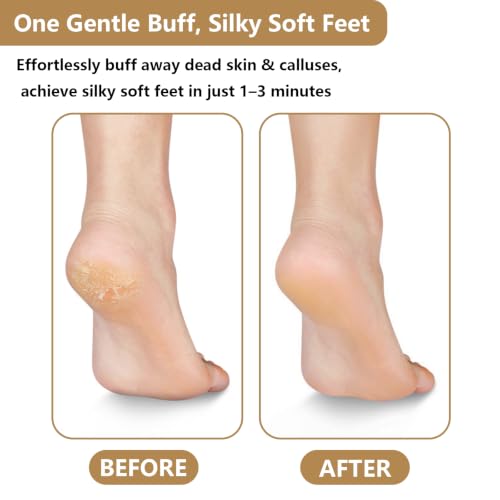 Glass Foot File,Nano Glass Foot Scraper with Ergonomic Handle,Golden - color: Golden