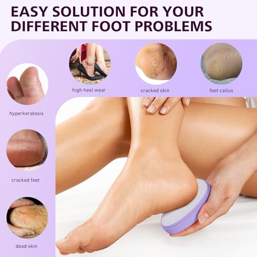 BALUCA Glass Foot File Callus Remover for Feet - Nano Glass Foot Scraper Scrubber Dead Skin Removal for Cracked Heels,Professional Pedicure Tool for Home, Salon, and Travel (Purple) - color: Purple