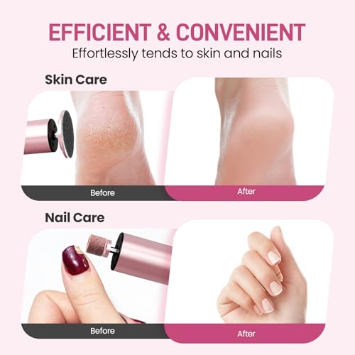 2-in-1 Electric Foot Callus Remover, Self Care Gifts for Women Mom Lover - color: Pink