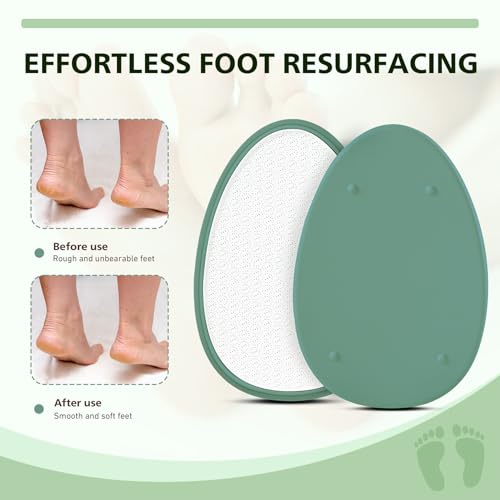 BALUCA Glass Foot File Callus Remover for Feet - Nano Glass Foot Scraper Scrubber Dead Skin Removal for Cracked Heels,Professional Pedicure Tool for Home, Salon, and Travel (Green) - color: Green