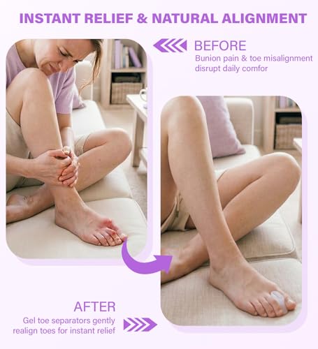 Gel Toe Spacers - Helps with Bunions, Corns, Blisters, Rubbing & Overlapping Toes - Toe Separators for Women & Men to Correct Toes - 12 Pack (S) - size: S
