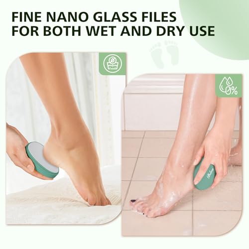 BALUCA Glass Foot File Callus Remover for Feet - Nano Glass Foot Scraper Scrubber Dead Skin Removal for Cracked Heels,Professional Pedicure Tool for Home, Salon, and Travel (Green) - color: Green