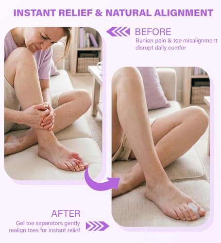 Gel Toe Spacers - 12 Pack (S+M+L) - size: S+M+L