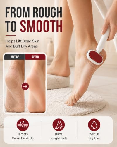 Dual Sided Foot Callus Remover Stainless Steel Blade Portable Dead - color: Red