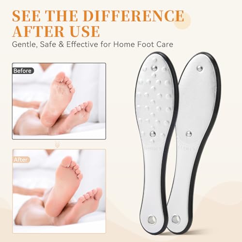 Dual-Sided Foot File Callus Remover (1 PCS), Metal Foot Scraper - color: Black