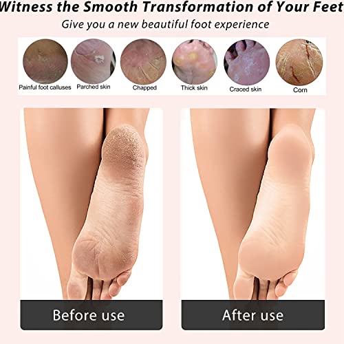 ICANdOIT 4 in 1 Bamboo Foot File Callus Remover Pedicure Scrubber 2 Pack - size: 2 Count (Pack of 2)