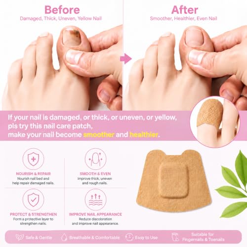 40Pcs Toenail Care Patches, Overnight Nail Repair Kit for Damaged Nail