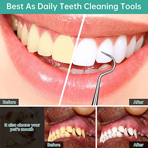 Professional Dental Scraper Tool - Dentist Pick, Dental Tarter Scraper