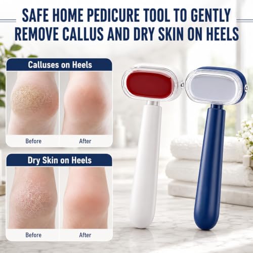 2PC Dual-Sided Foot Callus Remover with 4Blade,Stainless Steel Foot Scraper