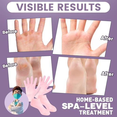 2 Pairs Silicone Socks Gloves Set for Dry Cracked Feet Hands, Size 10 - size: 1 Pair Socks & 1 Pair Gloves