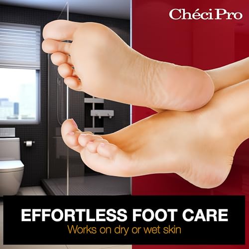 Checi Pro Nickel Foot File - Dual-Sided Foot Callus Remover for Dead Skin Feet Scrubber, Pedicure Tool - style: Medium Dual-sided