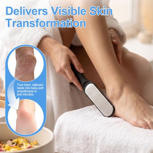 3-Pack Colossal Stainless Steel Foot File Callus Remover