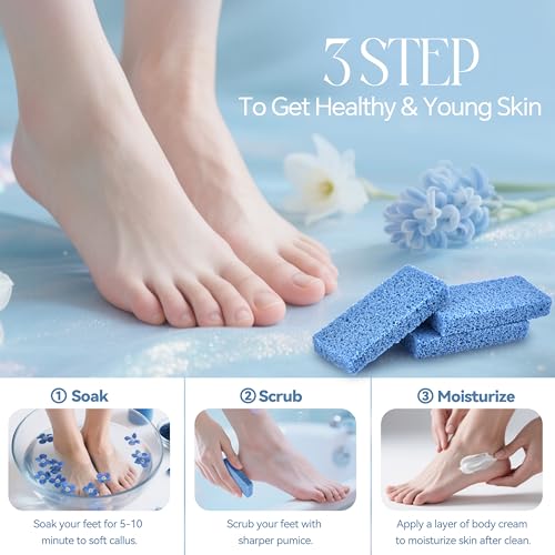 SALVMARY Foot Pumice Stone for Feet Callus Remover Scrubber Pads 40 Pcs