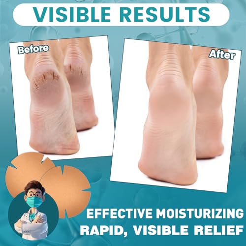 TEAWOO 30PCS Patented Cracked Heel Treatment Patches, New Upgraded Cracked Heel Repair Bandage (80mm x 80mm) - size: PURE