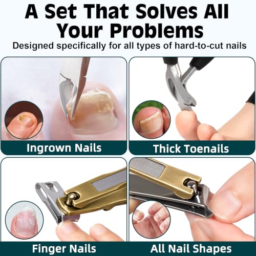Heavy Duty Toenail Clippers for Thick Ingrown Nails Fingernail Set - color: 8pack - Antique Bronze