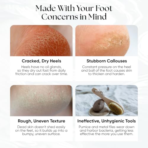 CheekyGlo Premium Glass Foot File (Sensitive) | Foot Exfoliator | Foot rasp | Nano-Glass Foot File | Callus Remover | The Original TikTok Viral Glass Foot File